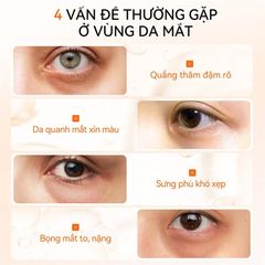 Kem mắt Lanbena Vitamin C Brightening Eye Cream 15ml