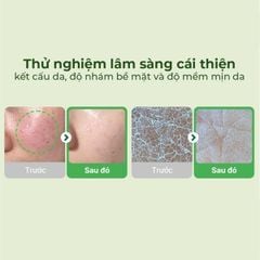 Toner Pad Torriden Balanceful Cica Toner Pad 60 miếng