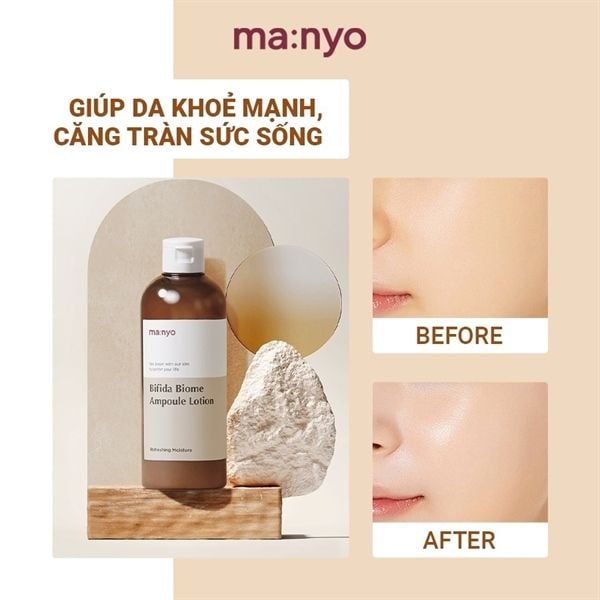Nước Hoa Hồng Manyo Bifida Biome Ampoule Toner 210ml