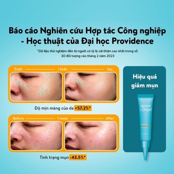 Gel Chấm Mụn Derma Angel Acne Care Intensive 10g