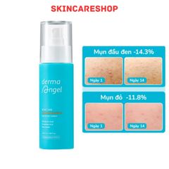 Xịt Dưỡng Da Toàn Thân Giảm Mụn Derma Angel Acne Care BHA Body Spray 100ml