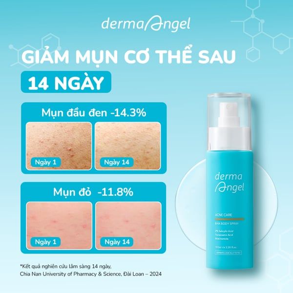 Xịt Dưỡng Da Toàn Thân Giảm Mụn Derma Angel Acne Care BHA Body Spray 100ml