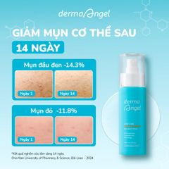 Xịt Dưỡng Da Toàn Thân Giảm Mụn Derma Angel Acne Care BHA Body Spray 100ml