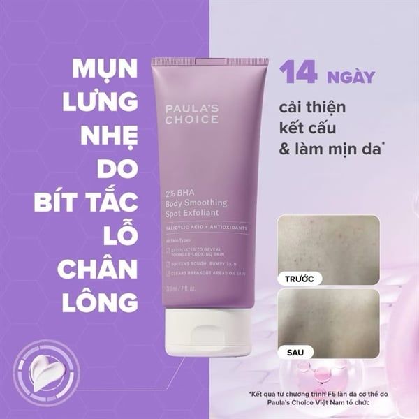 Kem Dưỡng Thể Paula's Choice 2% BHA Body Smoothing Spot Exfoliant 210ml