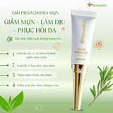  Combo giảm mụn tuổi dậy thì | Sữa rửa mặt 100ML và kem mụn Renoskin 