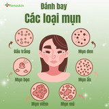  Combo giảm mụn tuổi dậy thì | Sữa rửa mặt 100ML và kem mụn Renoskin 