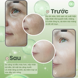  SERUM RETINOL BAKUCHIOL RENOSKIN 