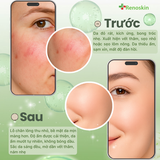  Combo dưỡng ẩm, phục hồi da | Kem HA Collagen & Serum B5GF Renoskin 