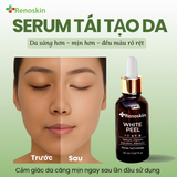  SERUM TÁI TẠO DA WHITE PEEL RENOSKIN 
