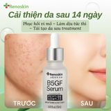  Serum dưỡng trắng, phục hồi da và ngừa thâm nám Renoskin B5GF 15ml 