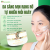  KEM DƯỠNG TRẮNG SÁNG NGỪA NÁM WHITENING SKIN RENOSKIN 