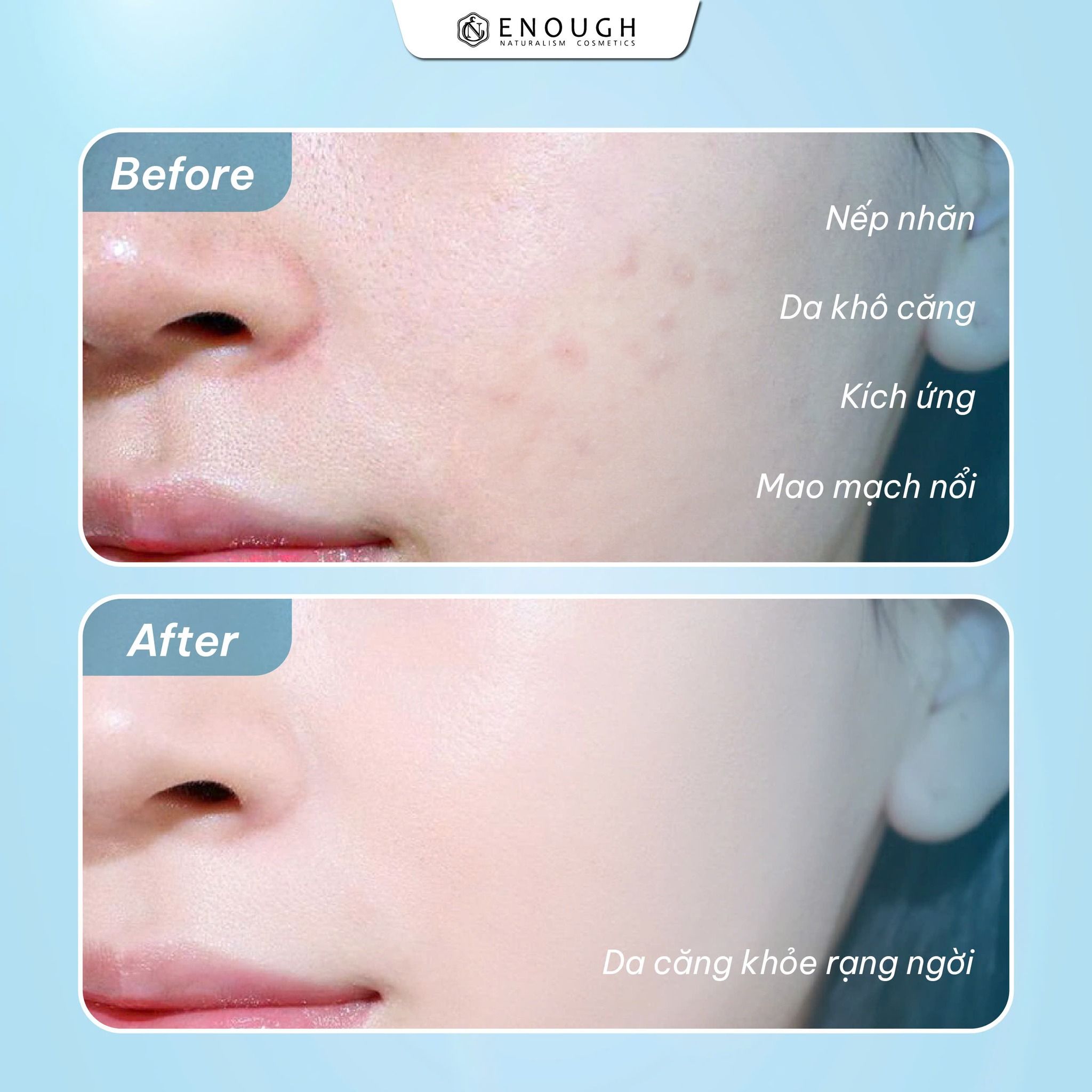 KEM DƯỠNG ẨM COLLAGEN 3X ENOUGH COLLAGEN 3X MOISTURE CREAM 50ML