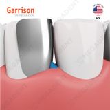  Fusion Anterior Matrix System - Bộ khuôn trám vùng răng trước 