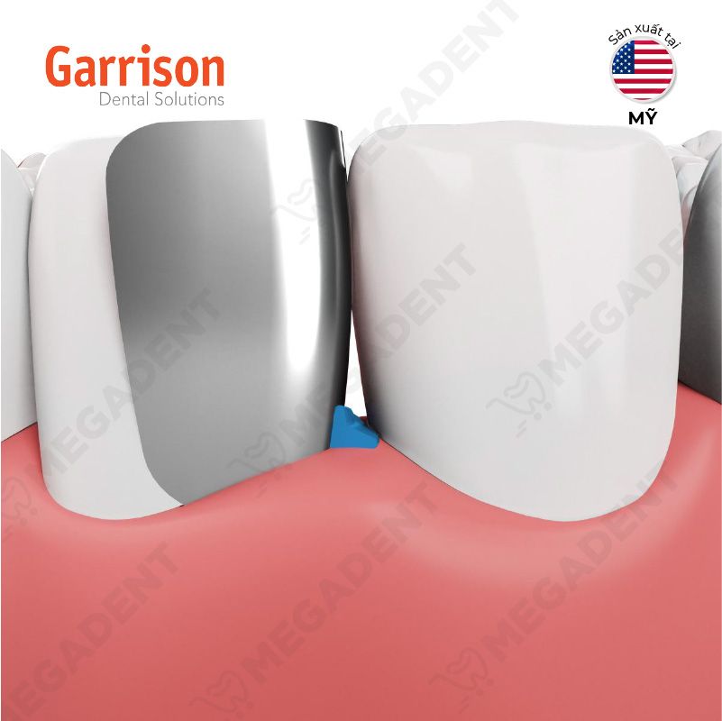  Fusion Anterior Matrix System - Bộ khuôn trám vùng răng trước 