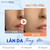 Tẩy tế bào chết dạng miếng Dewycel Salady Pad