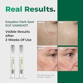 Huyết thanh làm sáng da, mờ nám EASYDEW DW-EGF MELATONING ONEDAY AMPOULE 1ml * 7 ống