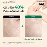 Huyết thanh làm sáng da, mờ nám EASYDEW DW-EGF MELATONING ONEDAY AMPOULE 1ml