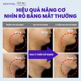 Mặt nạ nâng cơ 7 điểm toàn gương măt Dewycel 7 Lifting Mask
