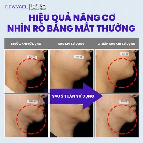 Mặt nạ nâng cơ 7 điểm toàn gương măt Dewycel 7 Lifting Mask