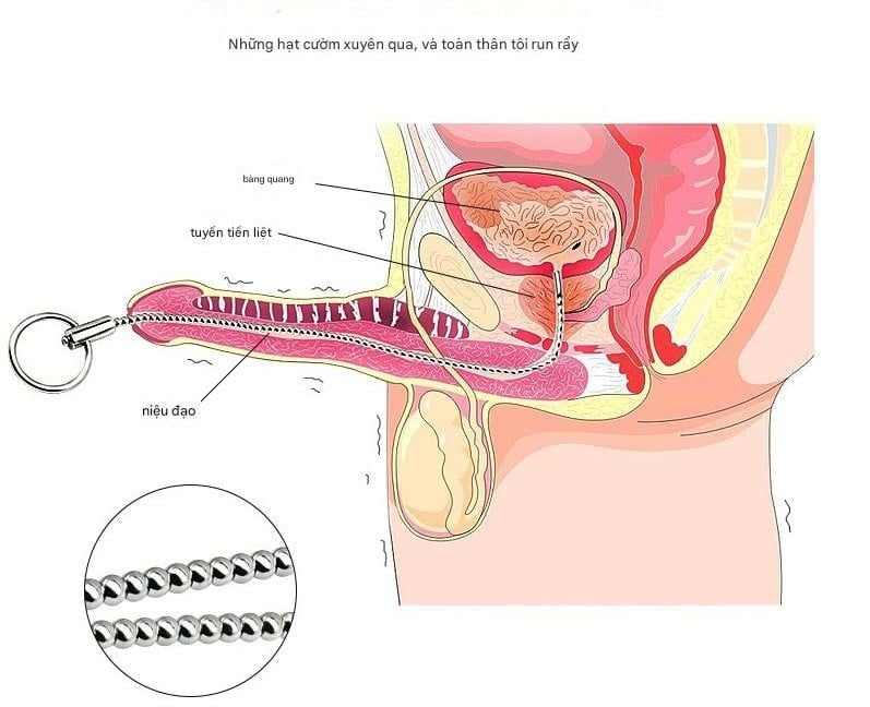 Que Sounding/Thông Tiểu inox 304 Kích thích Niệu Đạo, Đồ Chơi BDSM [Mẫu đầu bo tròn]