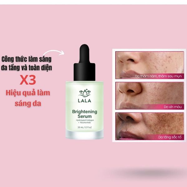 [CHÍNH HÃNG] Serum Sáng Da Đa Tầng Và Toàn Diện Thế Hệ Mới LALA Brightening Serum 30ml