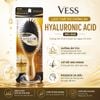 VESS Lược ChảiTóc Dưỡng Ẩm Hyaluronic Acid MO-500 - Gỡ Rối, Massage Da Đầu, Giảm Gãy Rụng (3261)