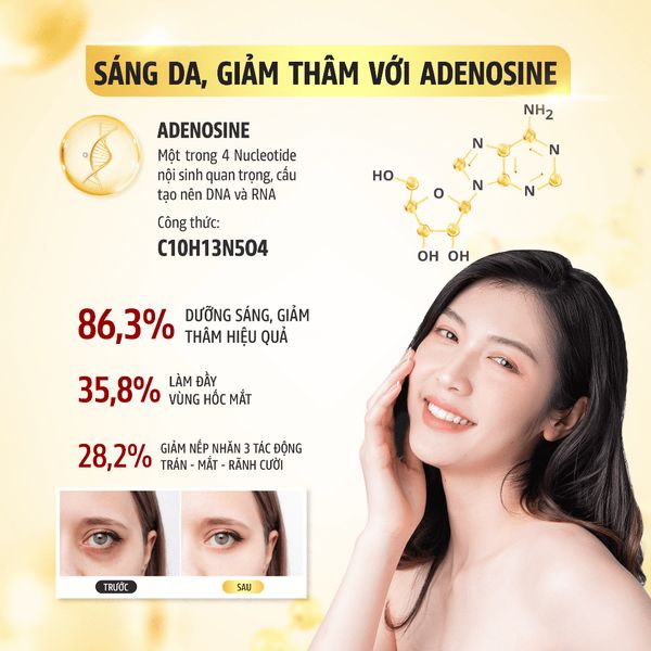Kem mắt chống lão hóa giảm quầng thâm bọng mắt Recipe Lifting Recipe Dark Cover Eye Cream 30ml