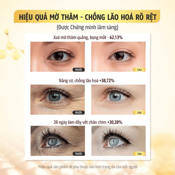 Kem mắt chống lão hóa giảm quầng thâm bọng mắt Recipe Lifting Recipe Dark Cover Eye Cream 30ml