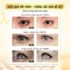 Kem mắt chống lão hóa giảm quầng thâm bọng mắt Recipe Lifting Recipe Dark Cover Eye Cream 30ml