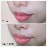  Dưỡng Môi SKINCLINIC - Coralip Sculptur Balm 15ml 