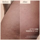  [CHÍNH HÃNG] Dầu Dưỡng Thể (Body) Hạnh Nhân Almond Supple Skin Oil 100ml 