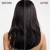  [Mai Lan]  Bộ Gội Và Huyết Thanh Trị Gàu Kerasilk Anti-Dandruff 