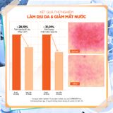  Combo 02 Nước hoa hồng Trà Xanh kiểm soát dầu và làm dịu cho da dầu mụn Isntree Green Tea Fresh Toner 200ml 