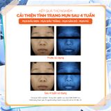  Nước hoa hồng Trà Xanh kiểm soát dầu và làm dịu cho da dầu mụn Isntree Green Tea Fresh Toner 200ml 