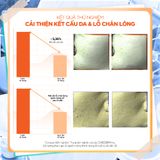  Nước hoa hồng Trà Xanh kiểm soát dầu và làm dịu cho da dầu mụn Isntree Green Tea Fresh Toner 200ml 