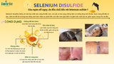  Selenium Sulfide 