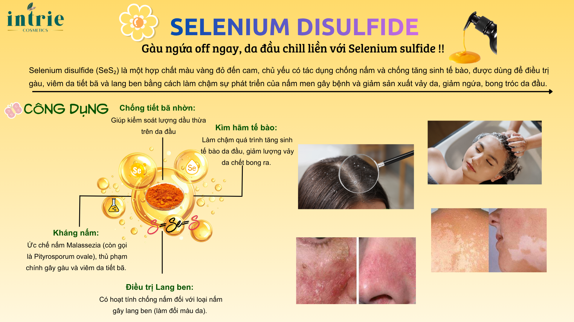  Selenium Sulfide 