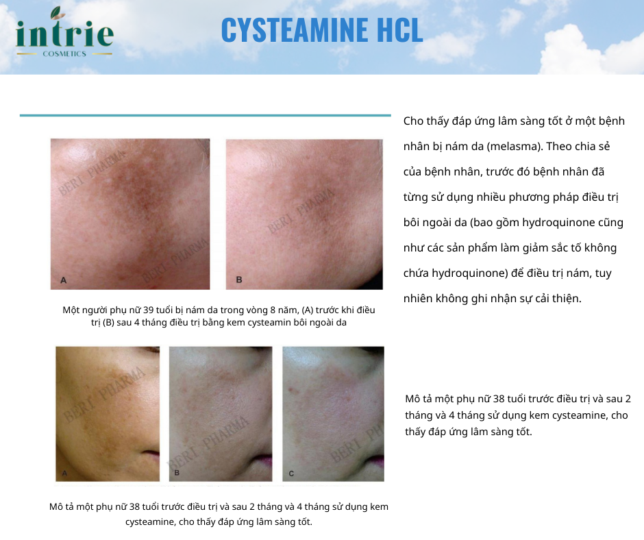  BeriCos® Cysteamine HLC 