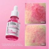  [ Tem LG ] Tinh Chất CNP Derma Answer Mela Spot Brightening Ampule Vit C /Active Boost PDRN /Pink Toning Deep-In Shot Ampule 