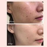  [Tem LG ] Cao trị nám Whoo Gongjinhyang Seol Radiant White Ultimate Corrector 