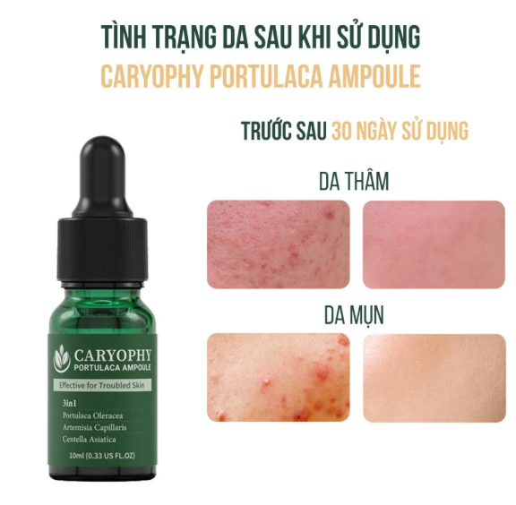 Serum Caryophy Portulaca Ampoule Giảm Mụn Mờ Thâm 30ML