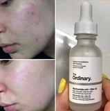 Serum Giảm Mụn The Ordinary Niacinamide 10% + Zinc 1% 30ml