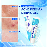  Gel Hỗ Trợ Giảm Mụn Mờ Thâm Acne DermaX Derma Gel Tuýp 18g 