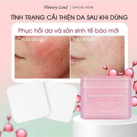 Toner Pad Collagen & Peptide FLOWERY LAND 170g Tăng Đàn Hồi Da Trẻ Hóa & Phục Hồi Da Cấp Ẩm Sâu nâng cơ vùng cằm