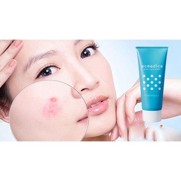 Sữa Rửa Mặt Trị Mụn Naris Acmedica 100G