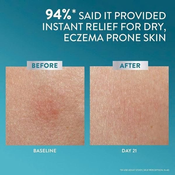 Kem Chữa Cho Viêm Da Cơ Địa Cetaphil Pro AD Derma Repair Cream 227g