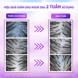  Dầu gội Himalaya Pink Salt Muối Hồng/ Da Đầu Ngứa/ Ngăn Rụng Tóc giúp mềm mượt óng ả 650ml 