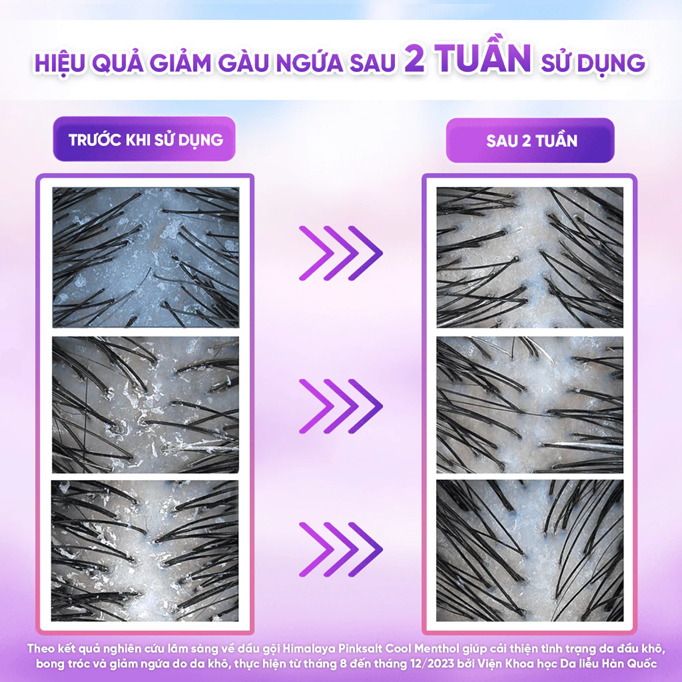  Dầu gội Himalaya Pink Salt Muối Hồng/ Da Đầu Ngứa/ Ngăn Rụng Tóc giúp mềm mượt óng ả 650ml 