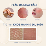  Sữa dưỡng thể Làm dịu kích ứng trong 20s & Khóa ẩm 72H cho da nhạy cảm Aveeno Skin Relief Body Lotion 354ml 