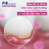  Kem đánh răng P/S Chuyên gia Chăm sóc nướu 100g giúp nướu khỏe, răng chắc, nụ cười trắng sáng 
